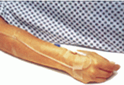 Sparadrap transpore