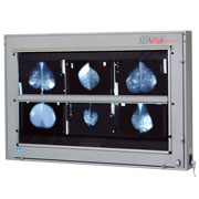 Négatoscope de mammographie SEN'X SX12