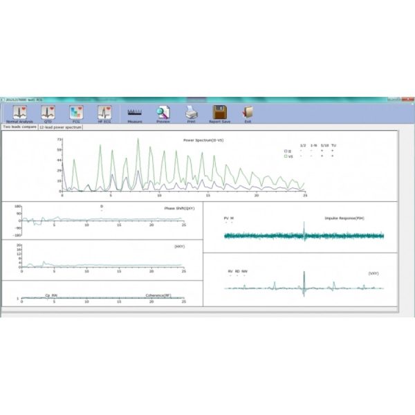 Electrocardiographe numérique USB EDAN SE-1010 – Image 4