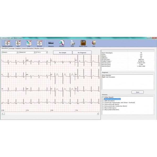 Electrocardiographe numérique sans fil EDAN SE-1010 – Image 2